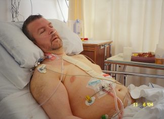 Að vakna eftir opna hjartaðgerð