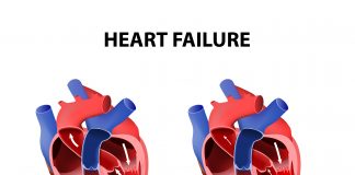 Mismunandi tegundir hjartabilunar